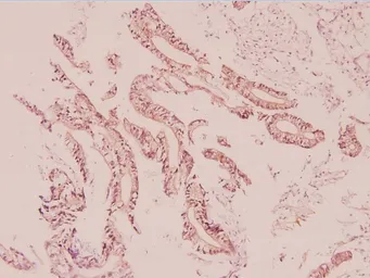 Anti-UCP2 antibody used in IHC (Paraffin sections) (IHC-P). GTX66704