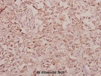 Anti-Arylsulfatase F antibody used in IHC (Paraffin sections) (IHC-P). GTX66710