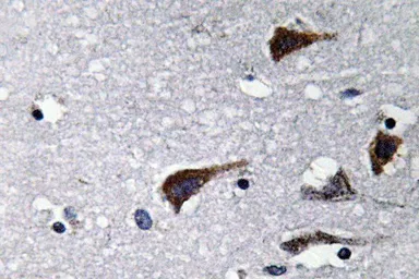Anti-Cathepsin B antibody used in IHC (Paraffin sections) (IHC-P). GTX66719