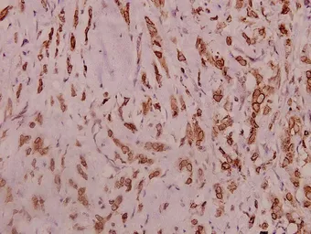 Anti-Nav1.2 antibody used in IHC (Paraffin sections) (IHC-P). GTX66721