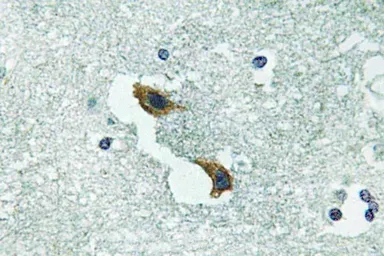 Anti-ATP7A antibody used in IHC (Paraffin sections) (IHC-P). GTX66723