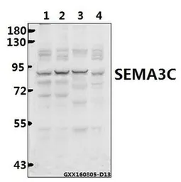Anti-SEMA3C antibody used in Western Blot (WB). GTX66725