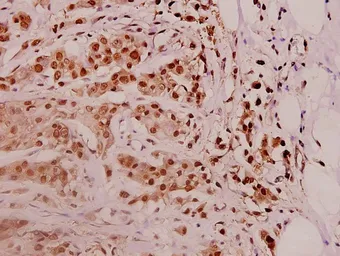 Anti-PSMD11 antibody used in IHC (Paraffin sections) (IHC-P). GTX66726