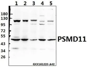 Anti-PSMD11 antibody used in Western Blot (WB). GTX66726