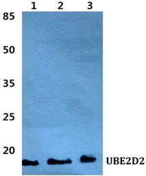 Anti-UBE2D2 antibody used in Western Blot (WB). GTX66747