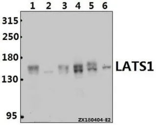 Anti-LATS1 antibody used in Western Blot (WB). GTX66748