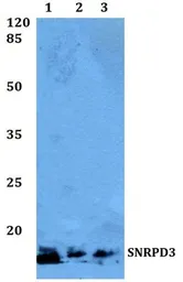 Anti-SNRPD3 antibody used in Western Blot (WB). GTX66749