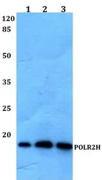 Anti-RPB8 antibody used in Western Blot (WB). GTX66751