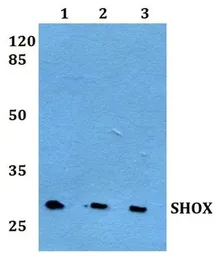 Anti-SHOX antibody used in Western Blot (WB). GTX66754