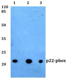 Anti-p22phox antibody used in Western Blot (WB). GTX66756