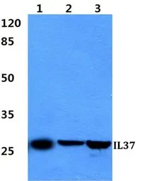 Anti-IL1F7 antibody used in Western Blot (WB). GTX66757