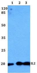 Anti-IL2 antibody used in Western Blot (WB). GTX66758