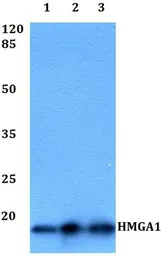 Anti-HMGA1 antibody used in Western Blot (WB). GTX66763