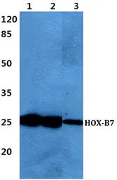 Anti-HOXB7 antibody used in Western Blot (WB). GTX66766
