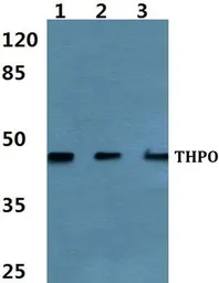 Anti-Thrombopoietin antibody used in Western Blot (WB). GTX66769