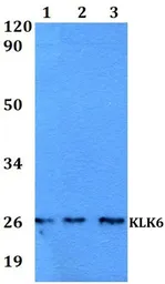Anti-Kallikrein 6 antibody used in Western Blot (WB). GTX66779