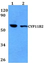Anti-CYP11B2 antibody used in Western Blot (WB). GTX66783