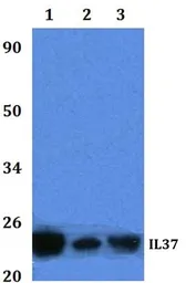 Anti-IL1F7 antibody used in Western Blot (WB). GTX66798