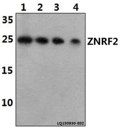 Anti-ZNRF2 antibody used in Western Blot (WB). GTX66801