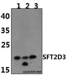 Anti-SFT2D3 antibody used in Western Blot (WB). GTX66804