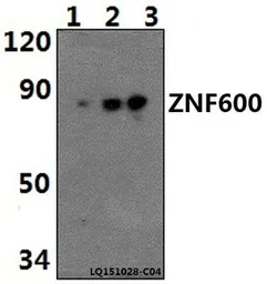 Anti-ZNF600 antibody used in Western Blot (WB). GTX66805