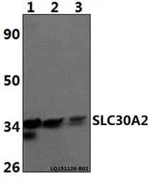 Anti-SLC30A2 antibody used in Western Blot (WB). GTX66806