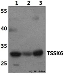 Anti-TSSK6 antibody used in Western Blot (WB). GTX66809