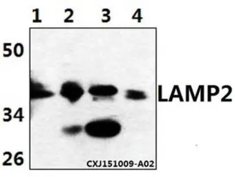 Anti-LAMP2 antibody used in Western Blot (WB). GTX66812