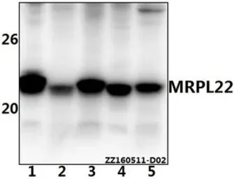 Anti-MRPL22 antibody used in Western Blot (WB). GTX66814