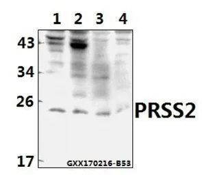 Anti-PRSS2 antibody used in Western Blot (WB). GTX66818