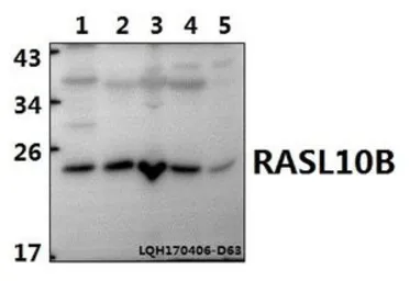 Anti-RASL10B antibody used in Western Blot (WB). GTX66819