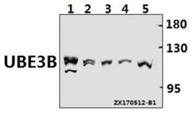 Anti-UBE3B antibody used in Western Blot (WB). GTX66821