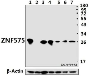Anti-ZNF575 antibody used in Western Blot (WB). GTX66823