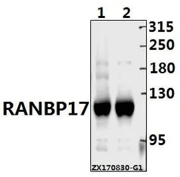 Anti-RanBP17 antibody used in Western Blot (WB). GTX66825