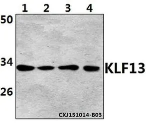Anti-KLF13 (acetyl lys166) antibody used in Western Blot (WB). GTX66827