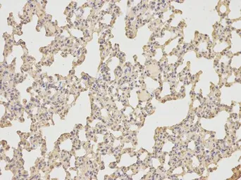 Anti-IL6 antibody used in IHC (Paraffin sections) (IHC-P). GTX66828