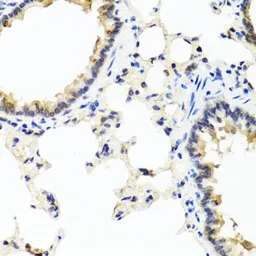 Anti-IL29 antibody used in IHC (Paraffin sections) (IHC-P). GTX66831