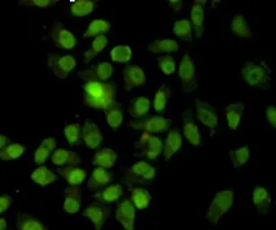 Anti-Ku70 antibody [7B1] used in Immunocytochemistry/ Immunofluorescence (ICC/IF). GTX66844