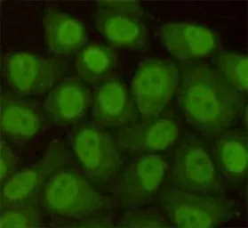 Anti-RAD23B antibody [5H1] used in Immunocytochemistry/ Immunofluorescence (ICC/IF). GTX66845