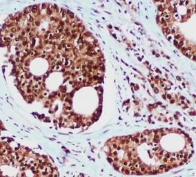Anti-RAD23B antibody [5H1] used in IHC (Paraffin sections) (IHC-P). GTX66845