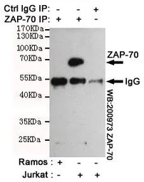 Anti-ZAP70 antibody [4B2] used in Immunoprecipitation (IP). GTX66846