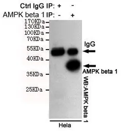 Anti-AMPK beta 1 antibody [1A7] used in Immunoprecipitation (IP). GTX66847