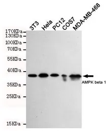 Anti-AMPK beta 1 antibody [1A7] used in Western Blot (WB). GTX66847