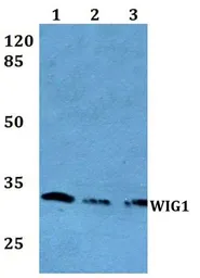 Anti-WIG1 antibody used in Western Blot (WB). GTX66858