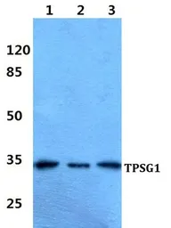 Anti-TPSG1 antibody used in Western Blot (WB). GTX66860