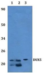 Anti-DUX5 antibody used in Western Blot (WB). GTX66865