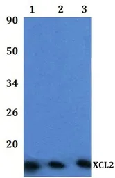 Anti-XCL2 antibody used in Western Blot (WB). GTX66866