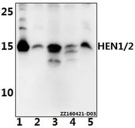 Anti-NHLH1 + NHLH2 antibody used in Western Blot (WB). GTX66872
