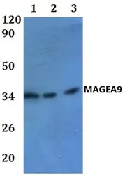 Anti-MAGEA9 antibody used in Western Blot (WB). GTX66873
