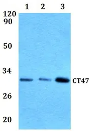 Anti-CT47 antibody used in Western Blot (WB). GTX66874